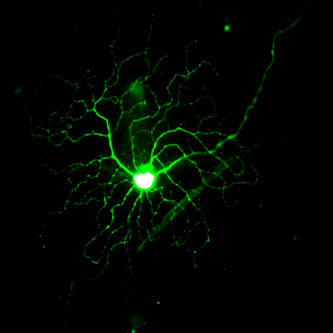 OFF Alpha Ganglion Cell Filled with Lucifer Yellow