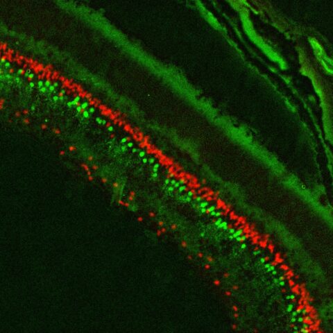 GFP & SOX2 Expression in Retina Slice