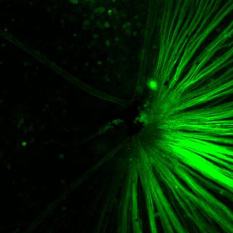 GcAMP Expression in Ganglion Cell Axons